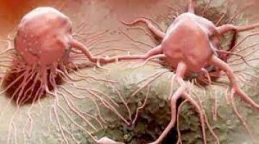 دراسات تكشف طرق لتقليل الإصابة بالسرطان