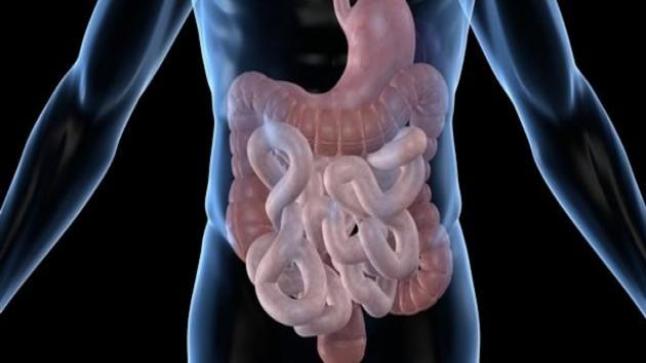 سعود الطبية :تكشف عن المقصود بمتلازمة الأمعاء القصيرة